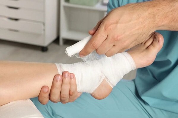 درمان زخم‌های دیابتی و سوختگی‌ با پانسمان دانش‌بنیان