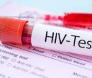 مهم‌ترین چالش امروز HIV در ایران